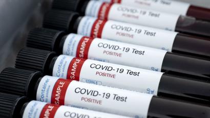 En Tierra del Fuego se sumó un solo caso de coronavirus positivo y el total asciende a 64
