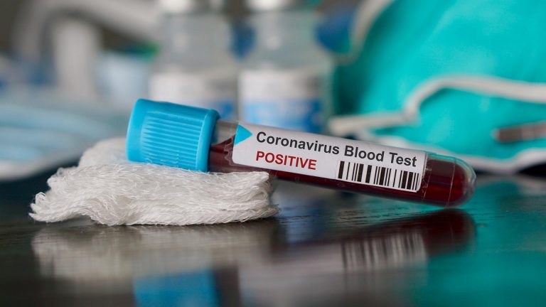 Coronavirus: No se registraron casos positivos y se suman cuatro nuevas altas en la provincia