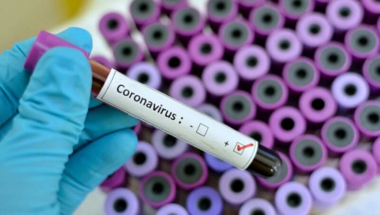 Coronavirus: Otros dos nuevos casos confirmados en Ushuaia y ya son 119 en la provincia