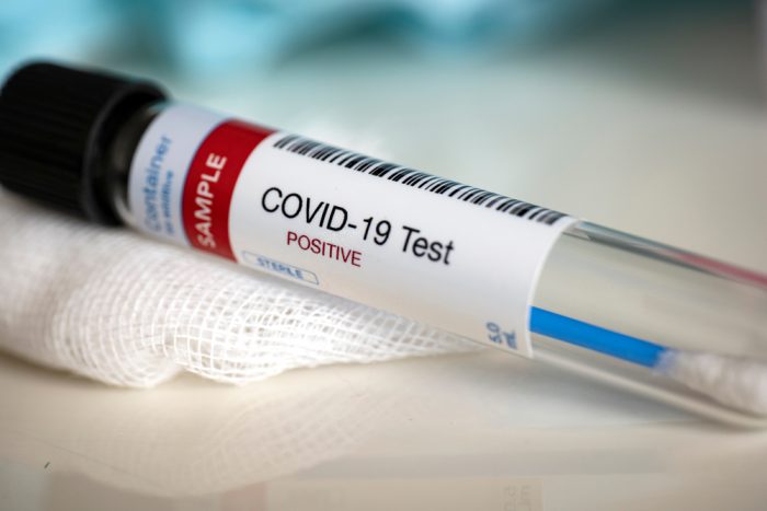 Coronavirus en Tierra del Fuego: Se registró un nuevo caso positivo de covid-19 en Ushuaia