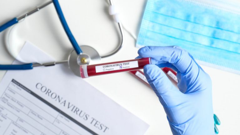 Coronavirus: El Ministerio de Salud confirmó un nuevo caso positivo de covid-19 en Ushuaia