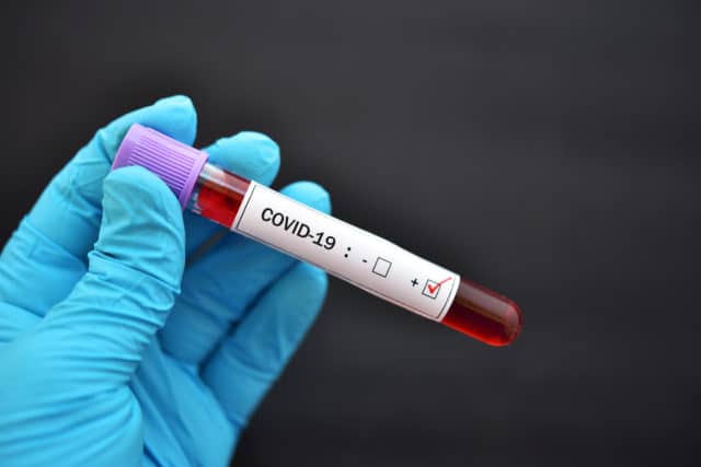Coronavirus en Tierra del Fuego: Se confirmaron 34 nuevos casos en Río Grande y otros 2 en Ushuaia